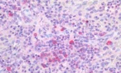 Immunohistochemistry-Paraffin: PIM1 Antibody [NBP3-14445] - Human Spleen: Formalin-Fixed, Paraffin-Embedded (FFPE)